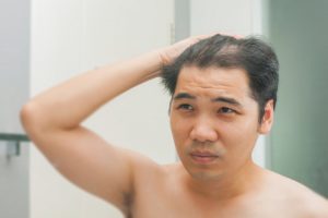 Young asian man standing in front of mirror concerned by hair loss